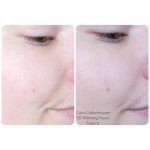 اسنس گالاکتومایسس ۹۵% کوزارکس (متعادل کننده رنگ پوست) - تصویر 6